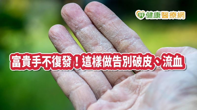 富貴手-破皮-流血-主圖