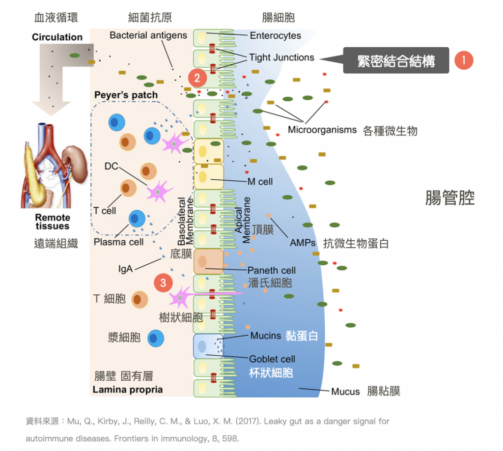 腸漏症-腸道健康-腸道環境