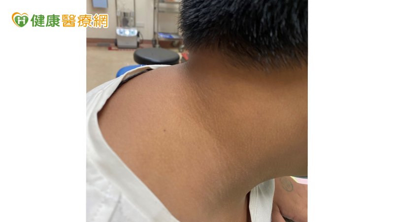 皮膚出現「這種」狀況　當心你被糖尿病盯上了！