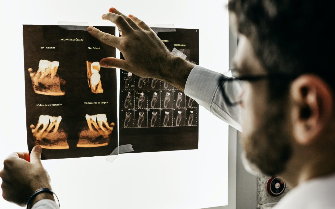 別以為牙齒抽過神經就沒事！２原因都需要再治療