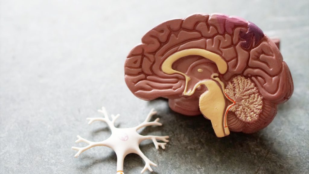 失智症-正常老化