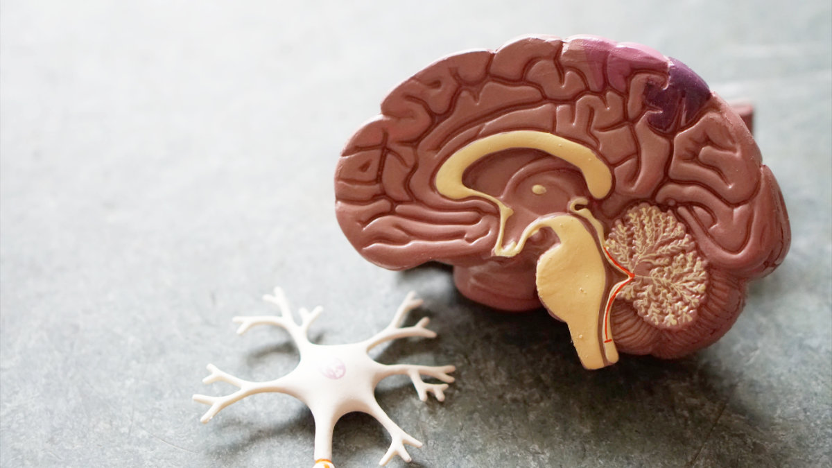 失智症-正常老化