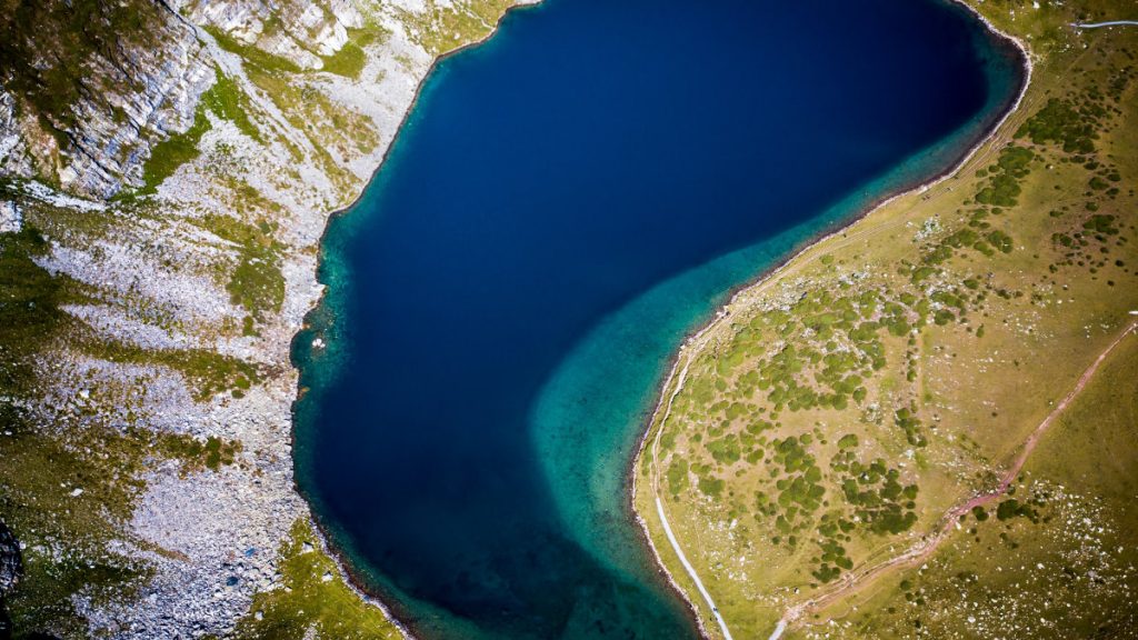 腰痛-感染-腎病-上行性尿路感染