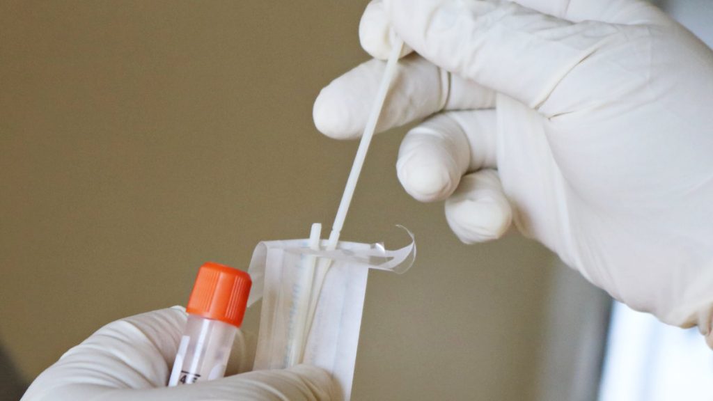 PCR檢測-快篩-COVID-19-SARS-CoV-2